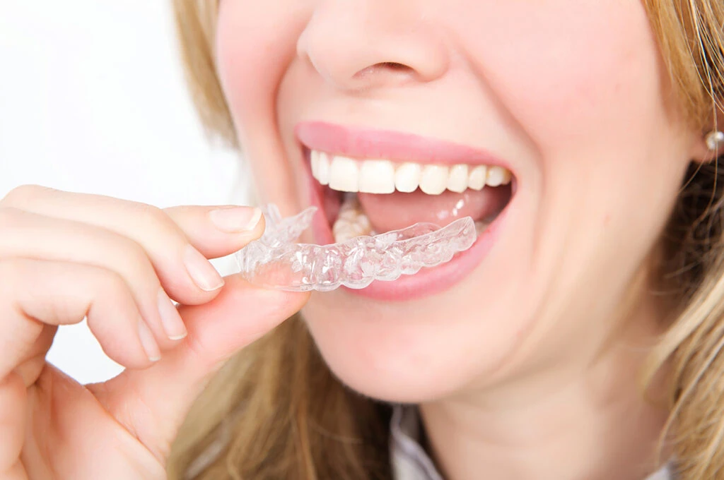 Wearing invisible braces tray