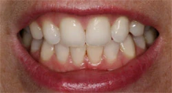 Dental surgery equipment and chair