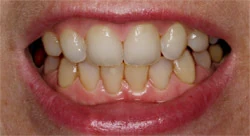 Dental surgery equipment and chair