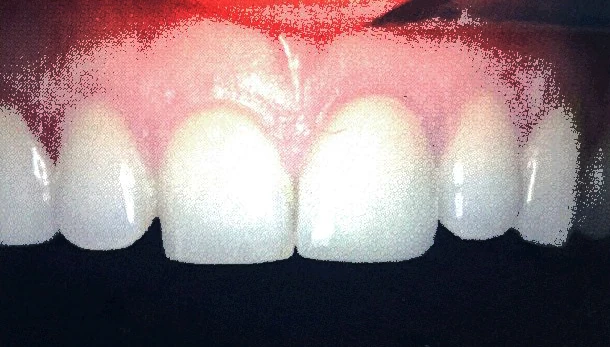 Dental surgery equipment and chair