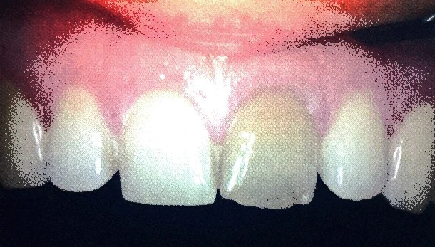 Dental surgery equipment and chair